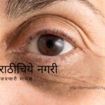 neettu-talks-home remedies for dark circles
